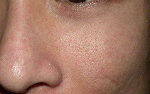 皮肤保养要趁早，20多岁用什么护肤品？